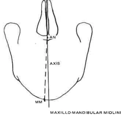 Manual Illustration